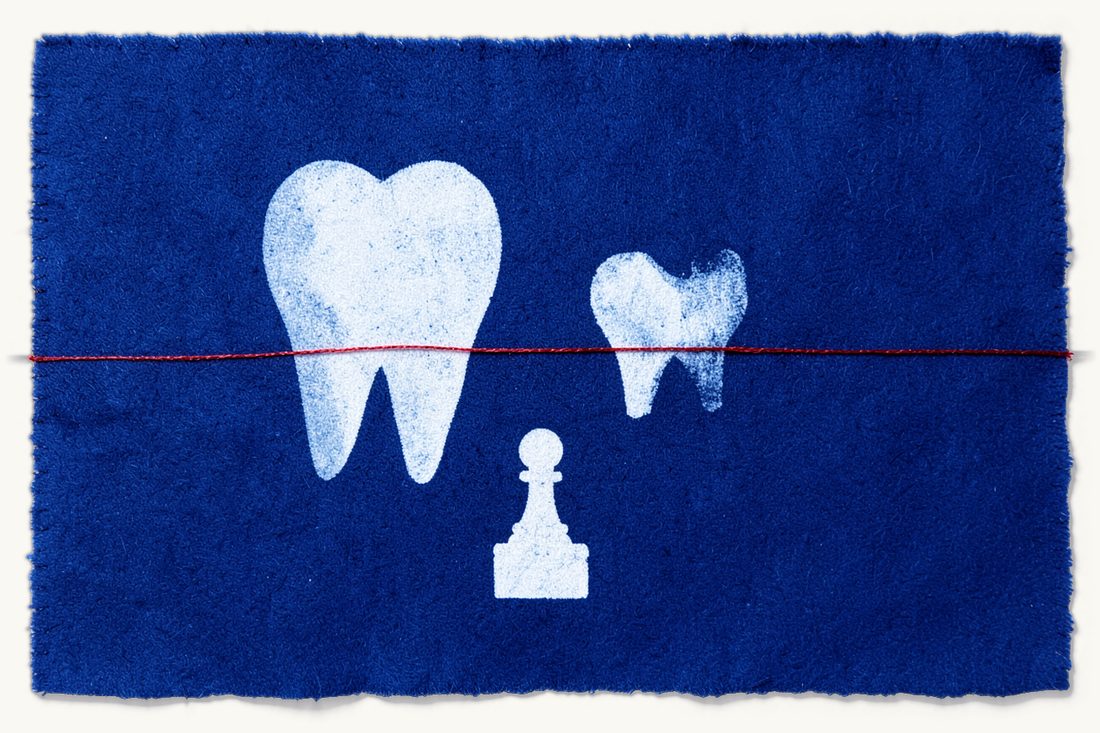 Dental veneer treatment gone wrong in Türkiye: two large tooth silhouettes, one whole and one ground down to a stub, joined by a red thread, with a chess pawn and suitcase below, cyanotype print
